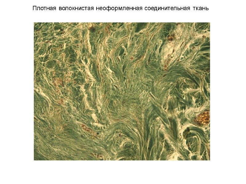 Плотная волокнистая неоформленная соединительная ткань